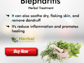 Herbal Remedies for blepharitis