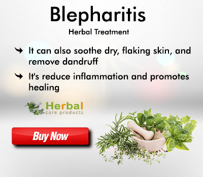 Herbal Remedies for blepharitis