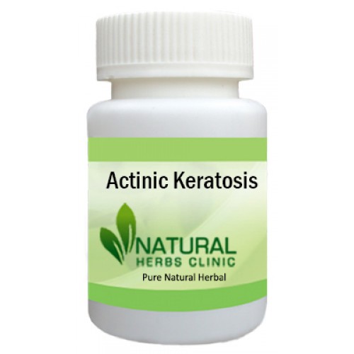 Herbal Supplements for Actinic Keratosis