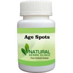 Herbal Supplements for Age Spots