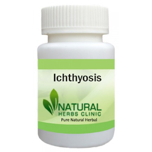 Herbal Supplements for Ichthyosis