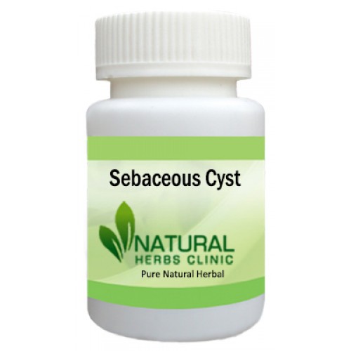 Herbal Supplements for Sebaceous Cyst