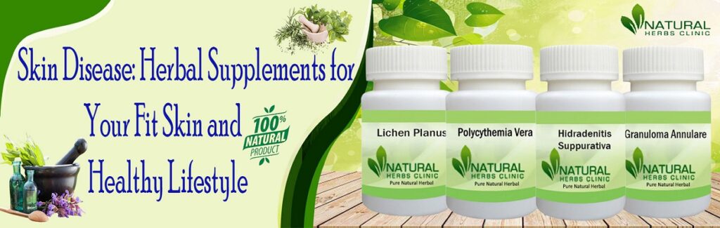 skin-disease-herbal-supplements-for-your-fit-skin-and-healthy