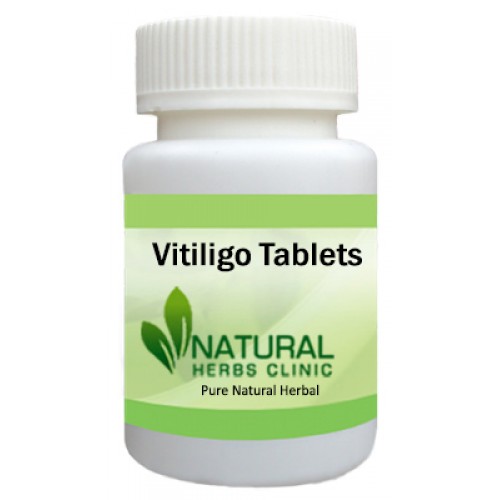Herbal Supplements for Vitiligo