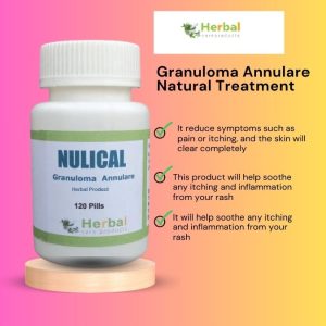 Granuloma Annulare Natural Treatment