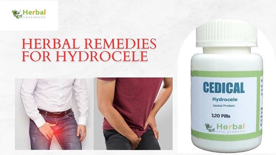 Herbal Remedies for Hydrocele 2