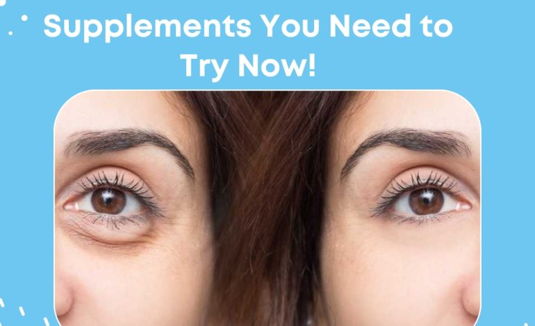 Dark Circles and Puffiness? The Supplements You Need to Try Now!