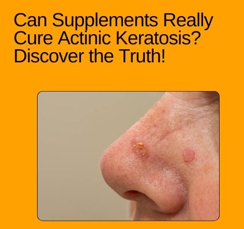 Can Supplements Really Cure Actinic Keratosis? Discover the Truth!
