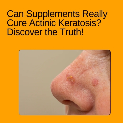 Can Supplements Really Cure Actinic Keratosis? Discover the Truth!