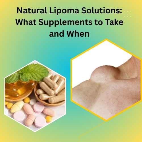 Natural Lipoma Solutions: What Supplements to Take and When