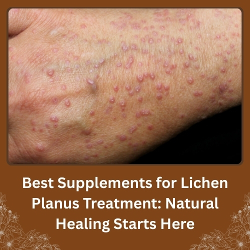 Best Supplements for Lichen Planus Treatment: Natural Healing Starts Here